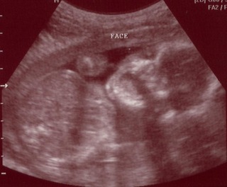 yawn1.jpg